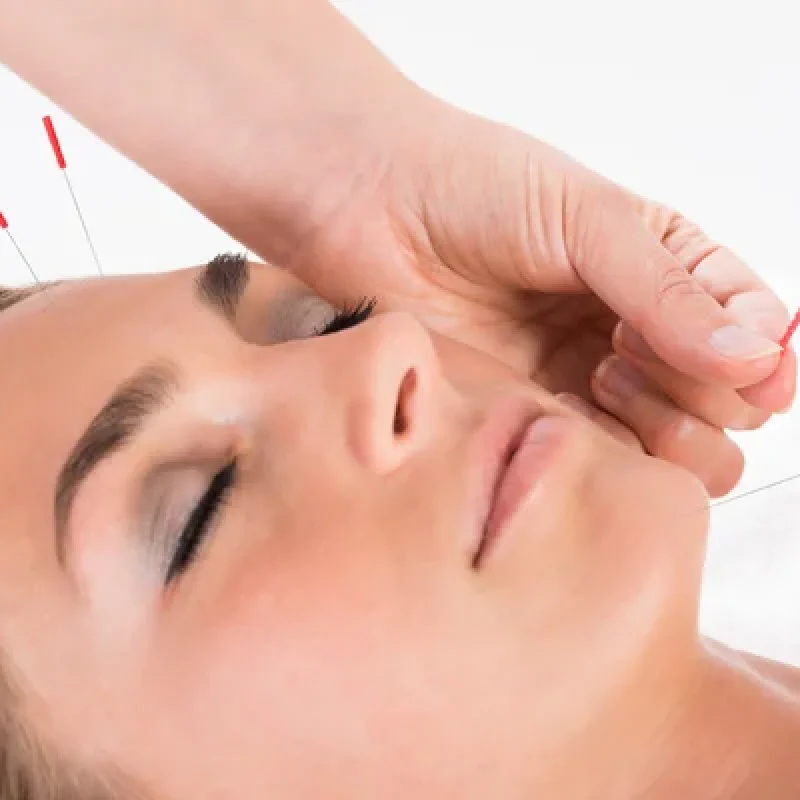 depositphotos_89551516-stock-photo-hand-performing-acupuncture-therapy-on